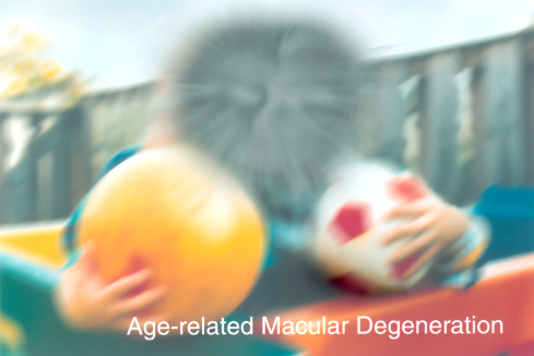 Vision with age-related macular degeneration