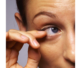 Woman with foreign object in eye Woman with foreign object in eye